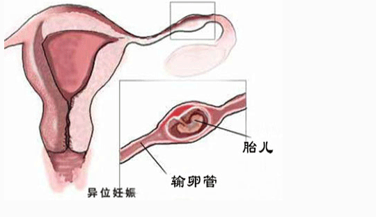 株洲中心医院可以做试管吗(株洲中心医院做试管怎么样)