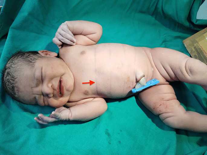 找人助孕多少钱，为生育带来新的希望